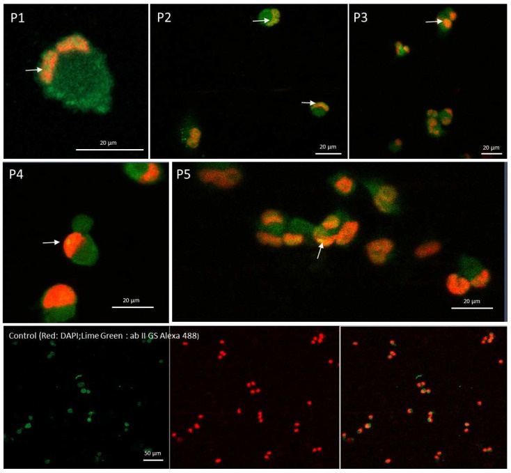 Vilon and STAT1 in macrophages from Avolio et al. 2022